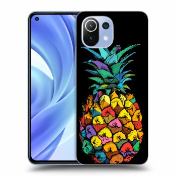 Hülle für Xiaomi Mi 11 Lite - Pineapple