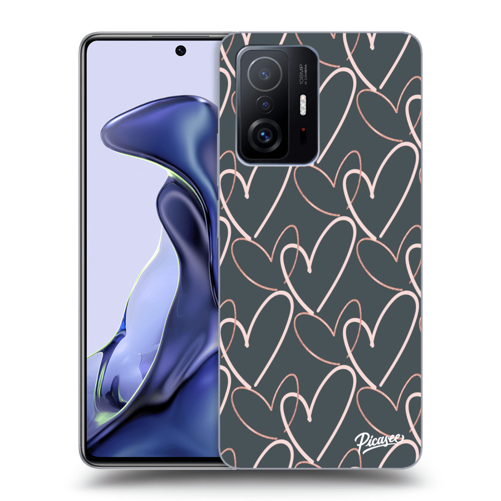 Picasee ULTIMATE CASE für Xiaomi 11T - Lots of love