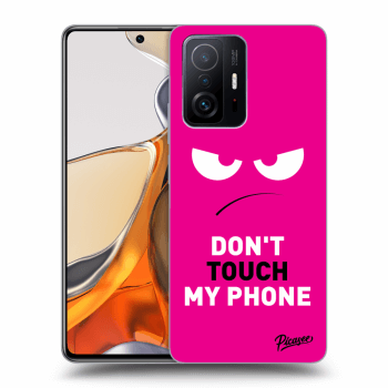 Picasee ULTIMATE CASE für Xiaomi 11T Pro - Angry Eyes - Pink