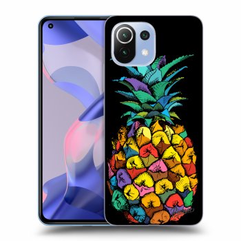 Hülle für Xiaomi 11 Lite 5G NE - Pineapple