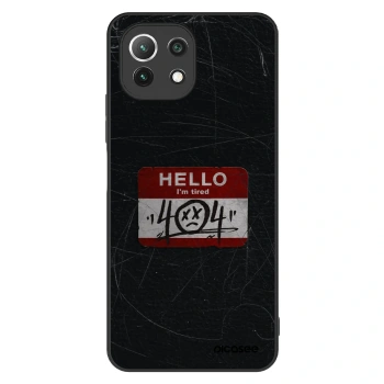 Hülle für Xiaomi Mi 11 Lite - HELLO 404
