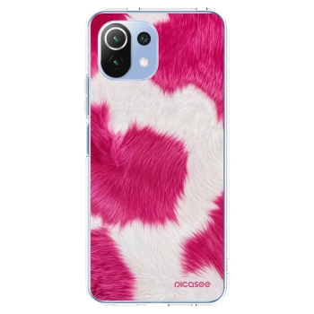 Picasee Xiaomi Mi 11 Lite Hülle - Transparentes Silikon - Pink Moo