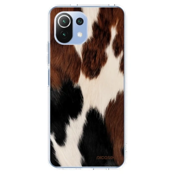 Picasee Xiaomi Mi 11 Lite Hülle - Transparentes Silikon - Rodeo