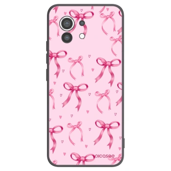 Picasee Xiaomi Mi 11 Hülle - Schwarzes Silikon - Bow Aesthetic