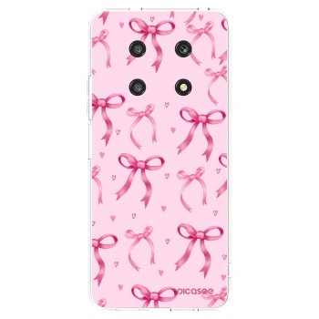 Picasee Honor Magic4 Lite 5G Hülle - Transparentes Silikon - Bow Aesthetic