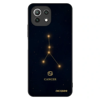 Hülle für Xiaomi Mi 11 Lite - CANCER