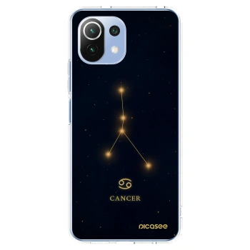 Picasee Xiaomi 11 Lite 5G NE Hülle - Transparentes Silikon - CANCER