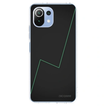 Picasee Xiaomi 11 Lite 5G NE Hülle - Transparentes Silikon - Consistency